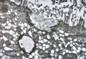 jejunum … unclassified vacuoles in enterocytes jejunum … unclassified vacuoles in enterocytes